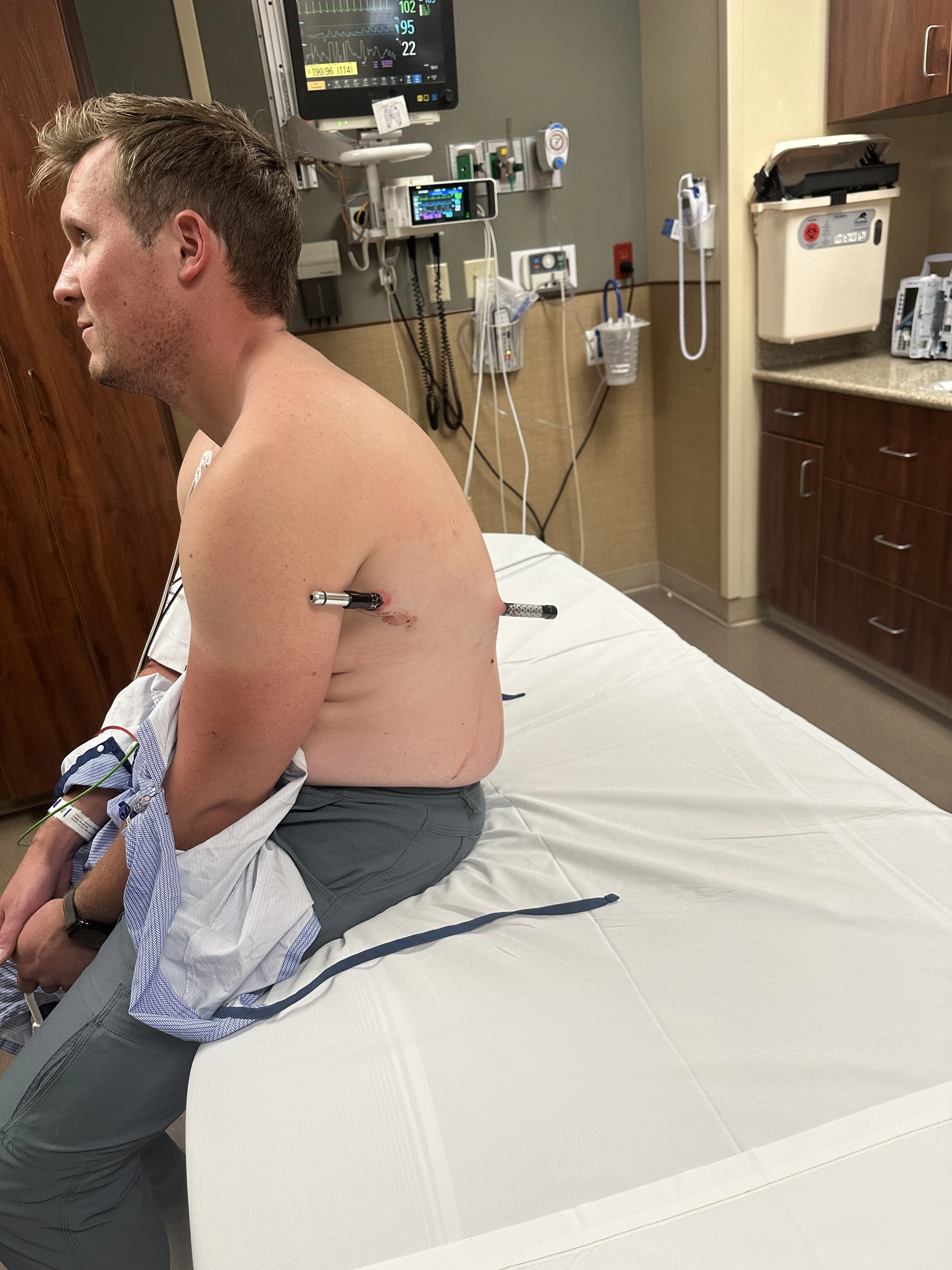 David Cifaldi schaffte es mit dem Stock schließlich ins St. Vincent Regional Hospital in Billings, Montana, in dem er selbst als Krankenpfleger arbeitet.